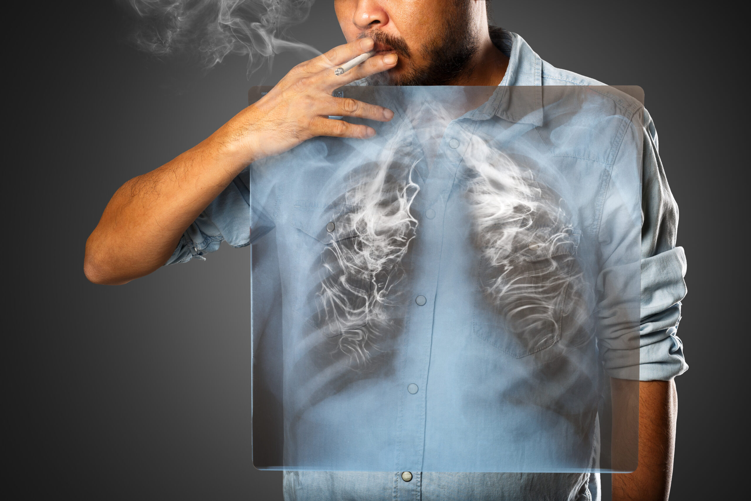 3 Things You Need to Know About the Effects of Smoking on Your Lungs